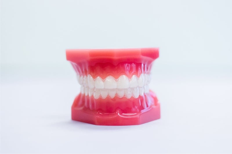 clear-aligners on plastic model