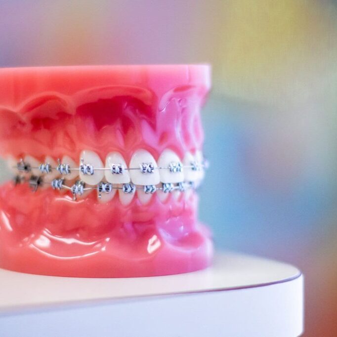 Orthodontist Clarksville